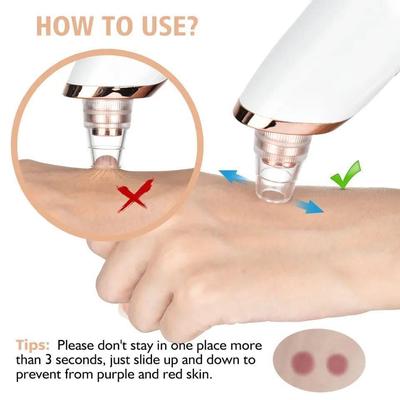 Electric Blackhead Remover Vacuum – Professional Pore Cleaner & Acne Needle Kit